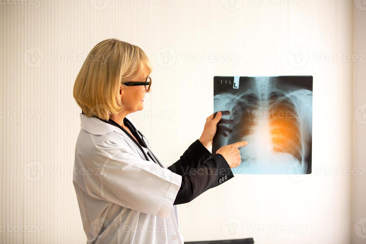 Female doctor show image of xray film to female patient and explain to her. photo