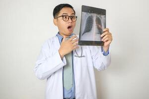 Shocked young asian doctor man wearing medical gown stethoscope hold X-ray of lungs fluorography roentgen spreading hands isolated on white background. Healthcare personnel health medicine concept photo
